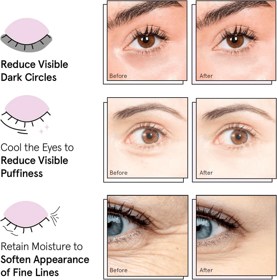 illuminating blue eye masks - Image 4