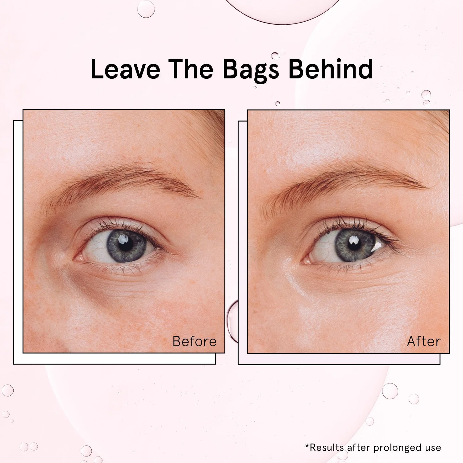 de-puffing eye serum roller - Image 5