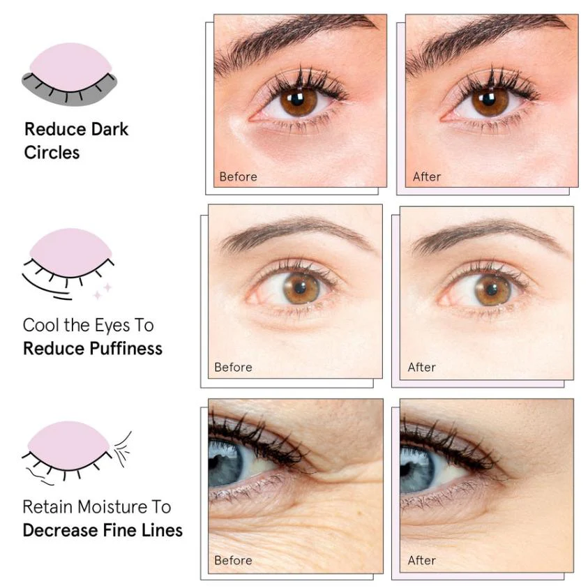 energizing eye masks - Image 4