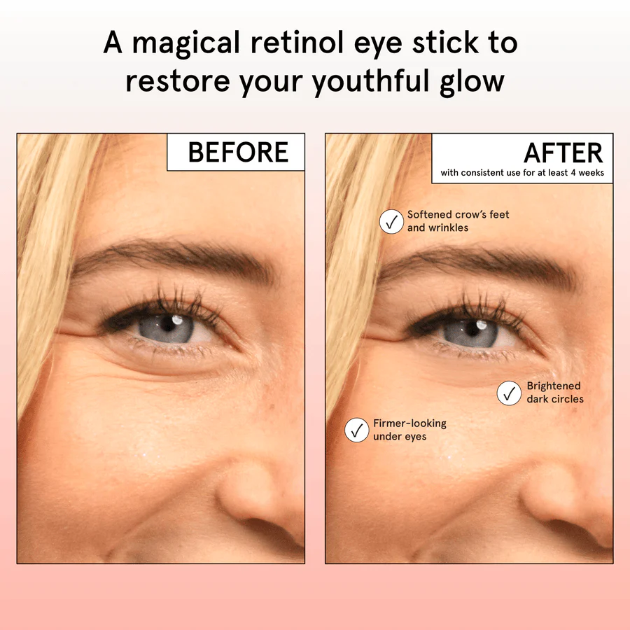 restoring eye balm - Image 3